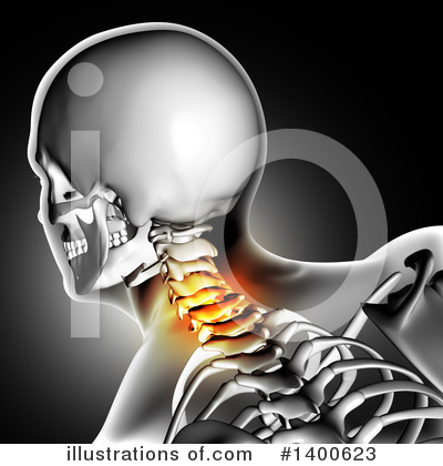 Neck Pain Clipart #1400623 by KJ Pargeter