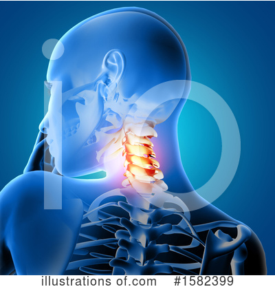 Neck Pain Clipart #1582399 by KJ Pargeter