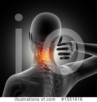 Neck Pain Clipart #1551616 by KJ Pargeter