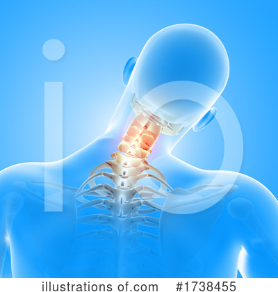 Neck Pain Clipart #1738455 by KJ Pargeter