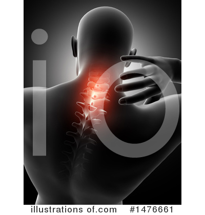 Neck Pain Clipart #1476661 by KJ Pargeter