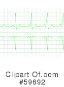 Electrocardiogram Clipart #59692 by oboy