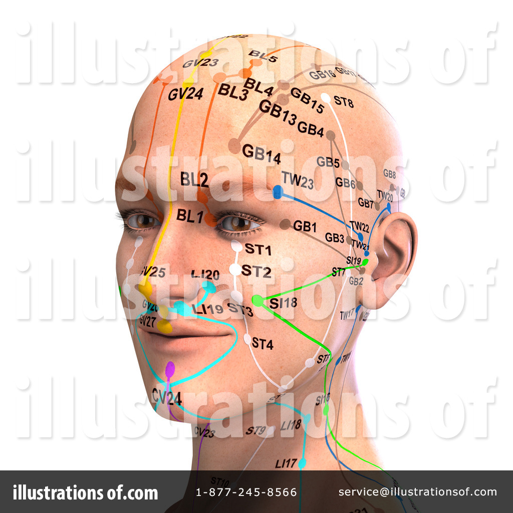 Acupuncture Clipart Illustration By Ralf61